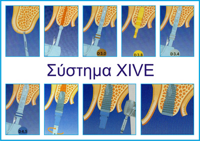 xive